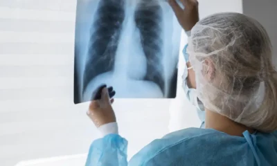 Tuberculosis en Argentina